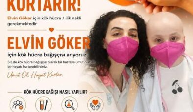 Elvin’e umut ol